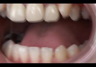 منہ دانت closeup